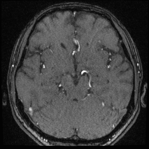 Click on the Serie image to view the images of VILLANUEVA, WILLIAM A.